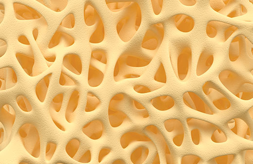 Bone Health (Osteoporosis) Home Test Kit UK